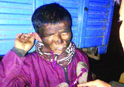 वडाध्यक्षमाथि बोक्सोको आरोप लगाउँदै कालोमोसो लगाएर मलमूत्र खुवाउने प्रयास