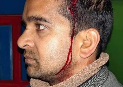 ठेकेदार भाइले अधिकृत कुटेपछि वडाअध्यक्ष पक्राउ